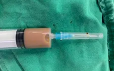 "Tiền mất, tật mang" vì tiêm thuốc không rõ nguồn gốc điều trị đau vùng thắt lưng