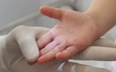 Nâng cao ý thức phòng bệnh tay chân miệng đang diễn biến phức tạp
