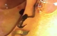 Đừng chủ quan với biến chứng nguy hiểm của bệnh sán lá gan