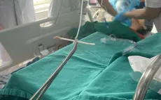 Người phụ nữ bị tăm bông mắc tại khí quản nguy kịch