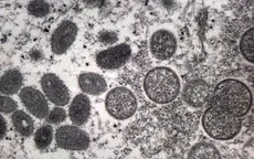 Chuyên gia Viện Pasteur TP. Hồ Chí Minh nhận định gì về nguy cơ lây lan bệnh đậu mùa khỉ?