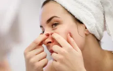 Đây là vùng da trên mặt có thể dẫn đến tử vong khi bạn nặn mụn