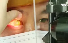 Nguy cơ bùng phát dịch đau mắt đỏ