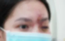 Nhiều người mất Tết vì biến chứng do làm đẹp