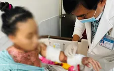Nướng mực bằng cồn, 2 chị em bị bỏng nặng