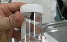Bé gái bị vắt ký sinh trong mũi sau chuyến dã ngoại cùng gia đình