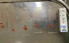 Thừa Thiên Huế ghi nhận ca bệnh sốt rét ngoại lai đầu tiên của năm 2024