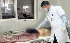 Nối thành công dương vật bị cắt đứt rời cho bệnh nhân