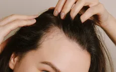 Điều gì xảy ra với mái tóc của phụ nữ trong thời kỳ mãn kinh?
