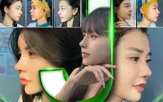 J-Line Top 5 thương hiệu nâng mũi uy tín tại TP Hồ Chí Minh
