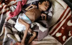 EU đóng góp 125 triệu Euro hỗ trợ nhân đạo cho người dân Yemen