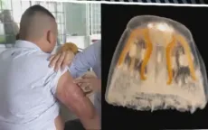 Nguy hiểm khó lường khi tắm biển gặp sứa độc