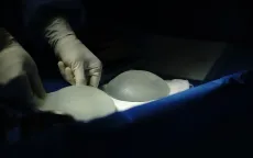 Ngực cứng sau phẫu thuật là một trong những dấu hiệu giả bao xơ