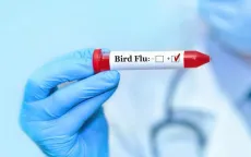 Ca nhiễm virus H5N2 tử vong do nhiều yếu tố