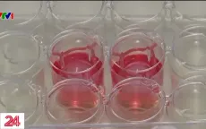 Da trong phòng thí nghiệm - hy vọng mới cho bệnh nhân Eczema
