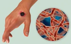 Trung Quốc đóng cửa trang trại gia súc do phát hiện một số ca bệnh than
