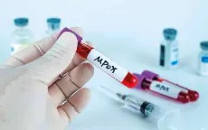 Thái Lan phát hiện du khách mắc bệnh đậu mùa khỉ trở về từ châu Phi