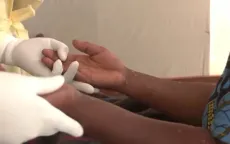 Ứng phó với biến thể đậu mùa khỉ mới
