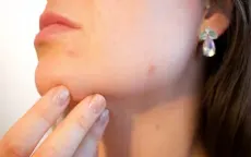 Thiếu vitamin B12 gây ra các vấn đề về da như thế nào?