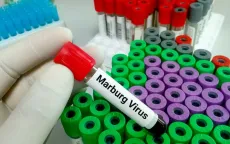 Mỹ ban hành cảnh báo đi lại tới Rwanda do dịch Marburg