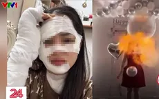 Cô gái ở Hà Nội bị bỏng mặt do nổ bóng bay trong tiệc sinh nhật