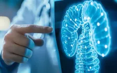 Ứng dụng trí tuệ nhân tạo trong chẩn đoán ung thư đại tràng
