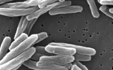 Số ca nhiễm lao ở trẻ em gia tăng tại châu Âu và Trung Á