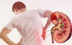 Cảnh báo rủi ro nghiêm trọng đối với sức khỏe xuất phát từ các vấn đề về thận
