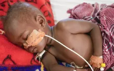 Giao tranh ở Nam Sudan chặn viện trợ dinh dưỡng cho 60.000 trẻ em