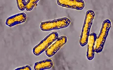 Mỹ ghi nhận đợt bùng phát vi khuẩn Listeria liên quan đến thực phẩm chế biến sẵn