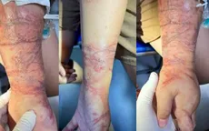Cảnh giác sứa đốt khi tắm biển