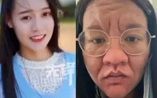 Mạng xã hội 'sốc' trước hình ảnh người phụ nữ xinh đẹp trở thành bà già khi mang thai