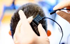 Đột phá thiết bị cấy ghép não AI giúp người câm nói và hát