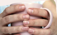 Những đốm trắng trên móng tay cảnh báo điều gì?