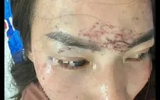 Bắt người, cắt tóc, xăm mặt vì ghen: Hai phụ nữ ở Cà Mau bị khởi tố