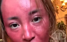 Không tẩy trang suốt 22 năm, gương mặt người phụ nữ Trung Quốc biến dạng đáng sợ