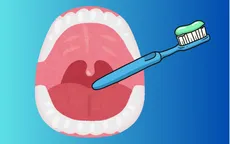 Dị vật không ngờ tới: Bàn chải đánh răng trong thực quản