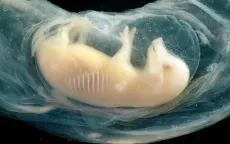 Lần đầu nuôi cấy thành công cấu trúc tim người đập suốt 21 ngày trong phôi lợn