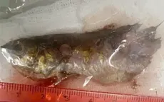 Cá rô đồng sống chui vào họng bé trai 4 tuổi, bác sĩ cấp cứu khẩn