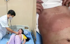 Phú Thọ: 16 trẻ mắc ban nhiễm khuẩn, phụ huynh cần cảnh giác