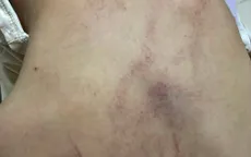 Bé 4 tuổi ở Hà Nội bị cô giáo kéo lê, ném vào tường: Tạm đình chỉ 2 giáo viên