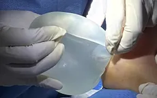 Tháo túi ngực cho phụ nữ có bệnh lý nền
