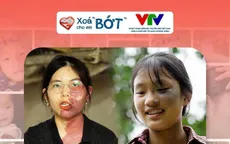 Đoàn Thanh niên Đài Truyền hình Việt Nam chính thức đồng hành cùng "Xóa 'bớt' cho em"