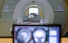 Đeo dây chuyền kim loại, người đàn ông Mỹ tử vong sau khi bị hút vào máy chụp MRI