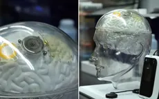 Cạnh tranh với Neuralink của Elon Musk, Trung Quốc "bắt kịp" Mỹ trong lĩnh vực cấy chip vào não người