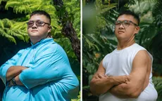 Trọng Nhân Bye Béo chính thức cắt da sau 6 tháng chờ đợi: Hành trình phẫu thuật kéo dài 1 năm