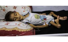 Liên hợp quốc: Khủng hoảng suy dinh dưỡng ở trẻ em Gaza chạm mức kỷ lục
