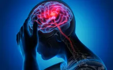 Đột quỵ ngày càng trẻ hóa