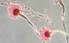 Phát hiện virus khiến nấm Aspergillus nguy hiểm hơn với con người