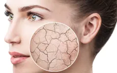 Bí quyết chống khô da hiệu quả trong mùa thu